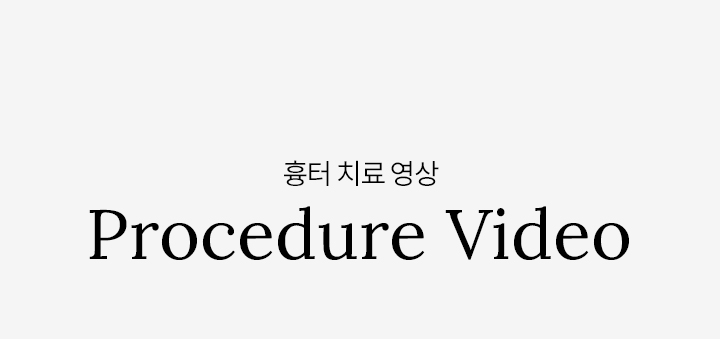 차앤유 흉터 치료 소개 영상
